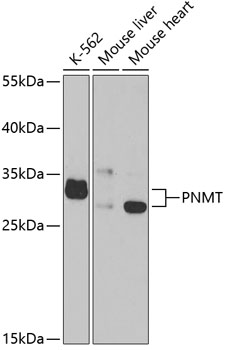 a02813 pnmt primary antiboties wb testing 1