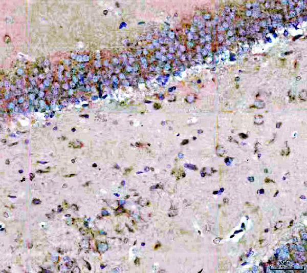 IHC analysis of EPS15R/EPS15L1 using anti-EPS15R/EPS15L1 antibody (A02815-2)