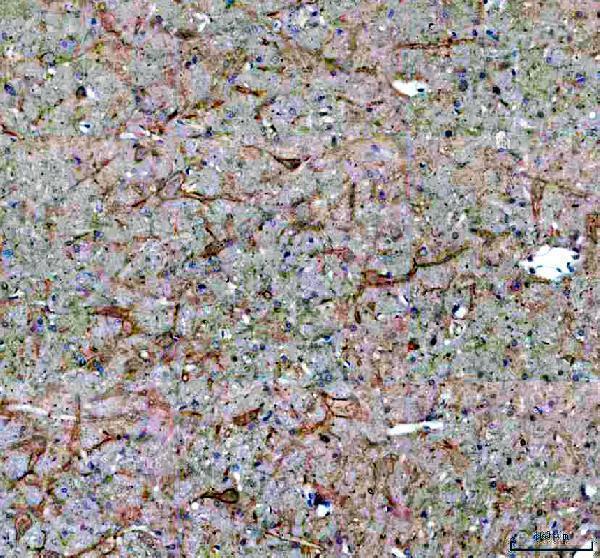 IHC analysis of EPS15R/EPS15L1 using anti-EPS15R/EPS15L1 antibody (A02815-2)