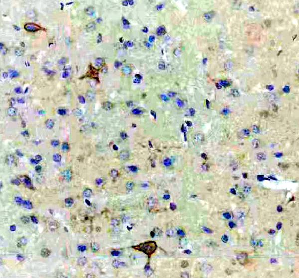 a02815 2 eps15l1 primary antibodies ihc testing 3