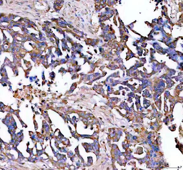 a02815 2 eps15l1 primary antibodies ihc testing 4