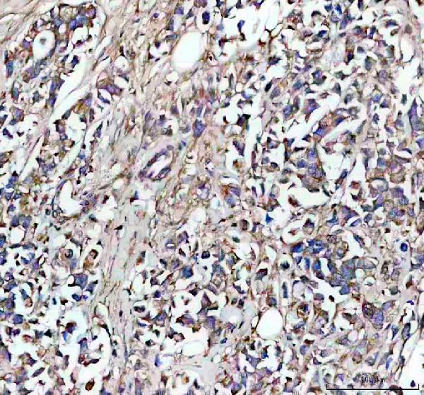 a02815 2 eps15l1 primary antibodies ihc testing 5