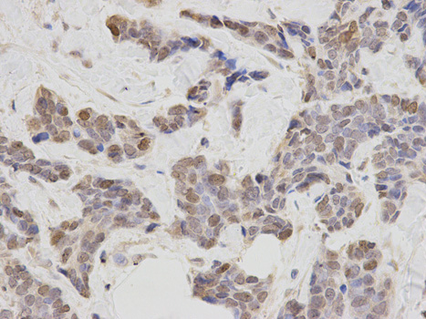 a02817 plcb1 primary antiboties ihc testing 2