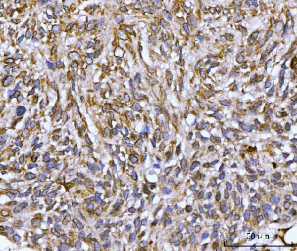  IHC analysis of Nesprin 2/SYNE2 using anti-Nesprin 2/SYNE2 antibody (A02818-1)