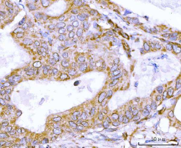  IHC analysis of Nesprin 2/SYNE2 using anti-Nesprin 2/SYNE2 antibody (A02818-1)