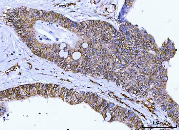 a02818 1 syne2 primary antibodies ihc testing 4