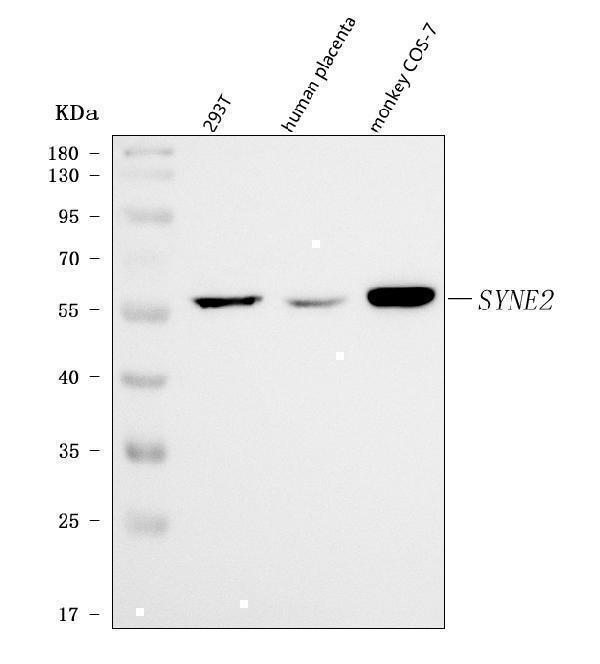  Western blot analysis of Nesprin 2/SYNE2 using anti-Nesprin 2/SYNE2 antibody (A02818-1)