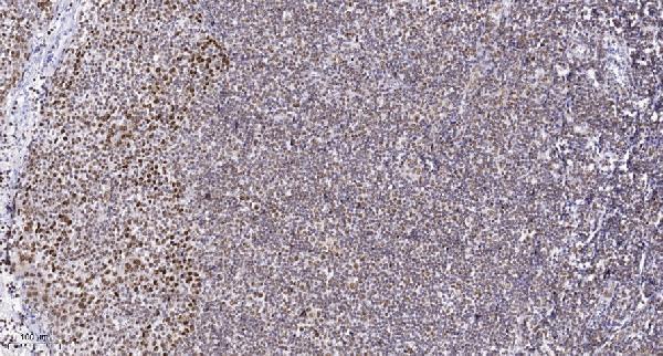 a02818 syne2 primary antibodies ihc testing 1