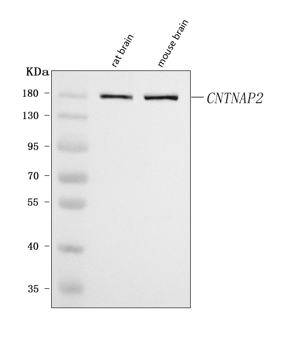  Western blot analysis of Caspr2/CNTNAP2 using anti-Caspr2/CNTNAP2 antibody (A02819-2)
