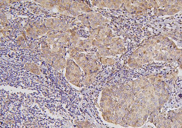 a02821 3 vtcn1 primary antibodies ihc testing 2