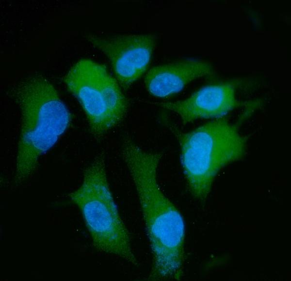 a02822 2 ppp2r1a primary antibodies if testing 4