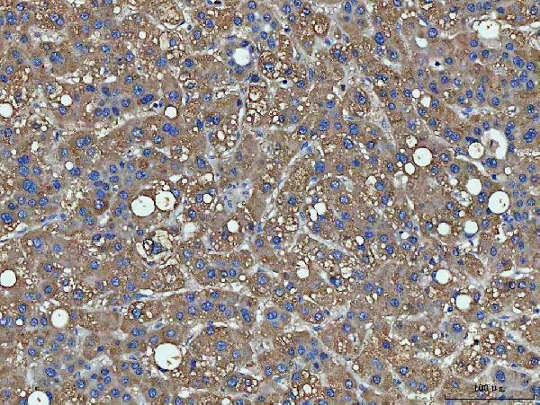 a02822 2 ppp2r1a primary antibodies ihc testing 2