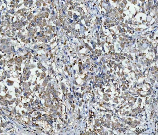 a02822 2 ppp2r1a primary antibodies ihc testing 3