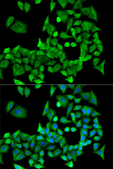 a02822 ppp2r1a primary antiboties if testing 2