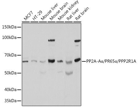 a02822 ppp2r1a primary antiboties wb testing 1