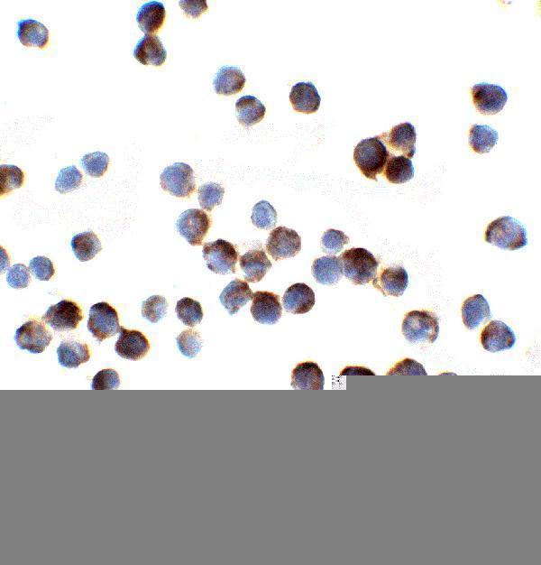 Immunocystochemistry of IL-1RAcP in HeLa cells with IL-1RAcP antibody at 2 μg/ml