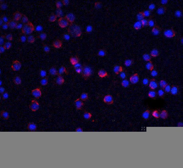 Immunofluorescence of IL-1RAcP in HeLa cells with IL-1RAcP antibody at 5 μg/mL