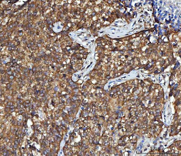 a02825 1 cbr1 primary antibodies ihc testing 4
