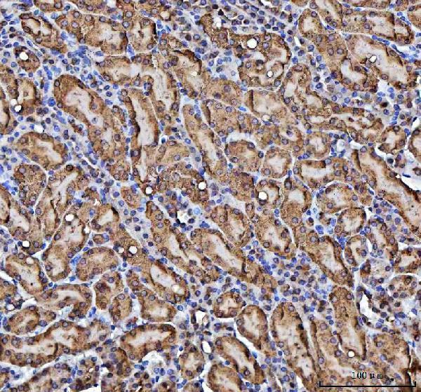 a02825 1 cbr1 primary antibodies ihc testing 6