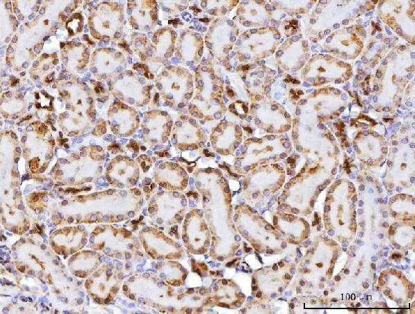 a02825 1 cbr1 primary antibodies ihc testing 7