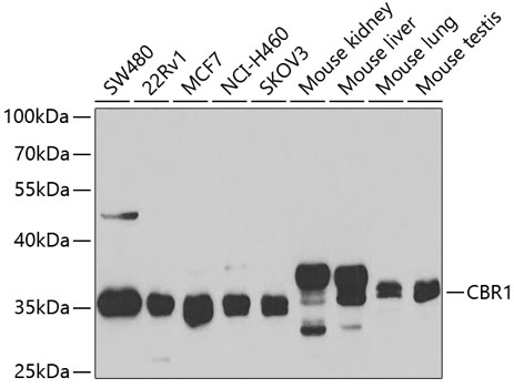 Western blot analysis of extracts of various cell lines, using CBR1 antibody  at 1:1000 dilution