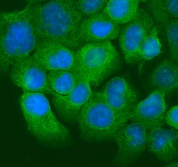 a02828 2 krt20 primary antibodies if testing 10
