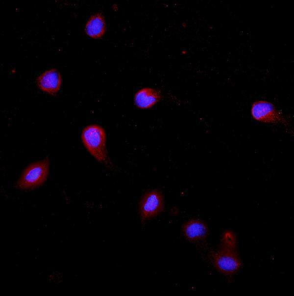 a02828 2 krt20 primary antibodies if testing 11