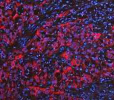 a02828 2 krt20 primary antibodies if testing 12