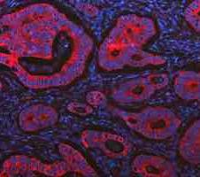 a02828 2 krt20 primary antibodies if testing 13