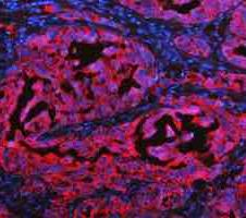 a02828 2 krt20 primary antibodies if testing 14