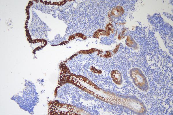 IHC analysis of Krt20 using anti-Krt20 antibody (A02828-2)