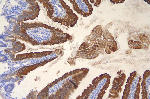 a02828 2 krt20 primary antibodies ihc testing 4_1