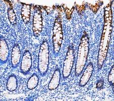 a02828 2 krt20 primary antibodies ihc testing 5