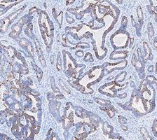 a02828 2 krt20 primary antibodies ihc testing 7