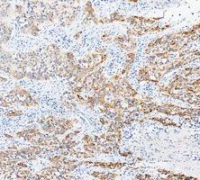 a02828 2 krt20 primary antibodies ihc testing 8