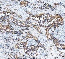 a02828 2 krt20 primary antibodies ihc testing 9