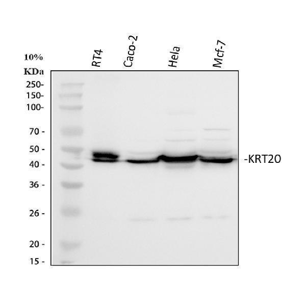  Western blot analysis of Cytokeratin 20/Krt20 using anti-Cytokeratin 20/Krt20 antibody (A02828-2)