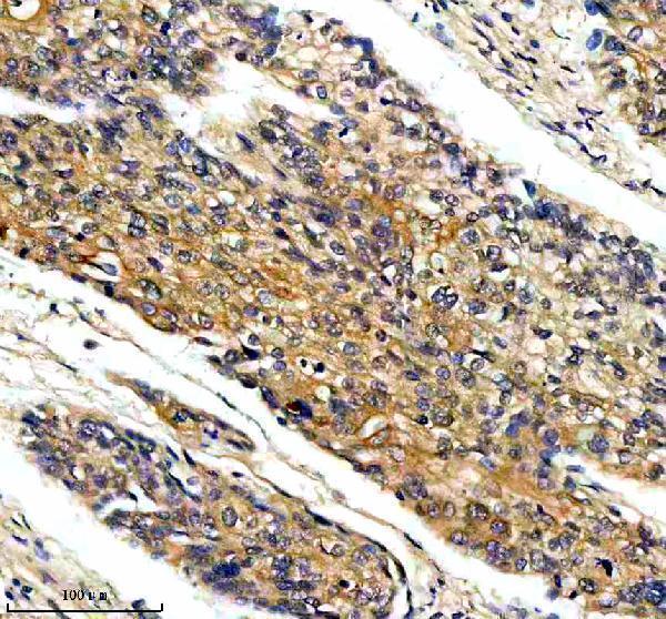 a02829 2 map4k4 primary antibodies ihc testing 1