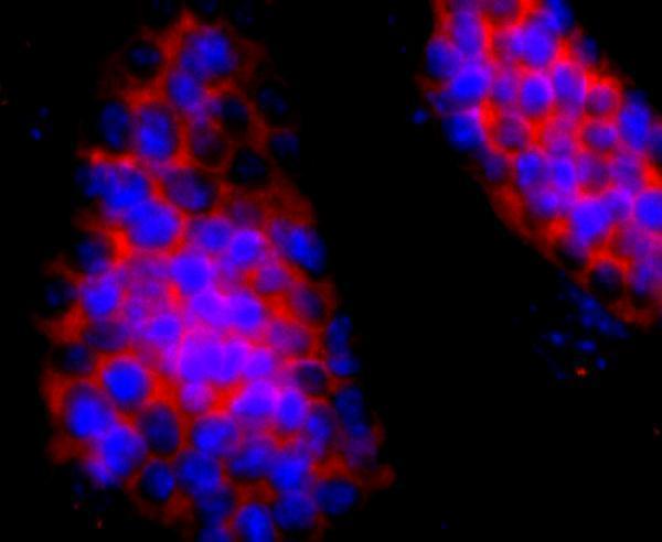 ICC staining HBG1/2 in D3 cells (red)