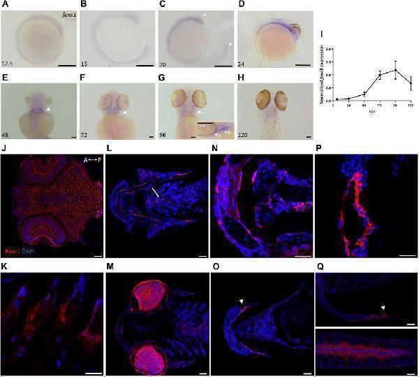Foxe1 is expressed in a range of larval tissues, including the oral epithelium, ethmoid plate, and the brain