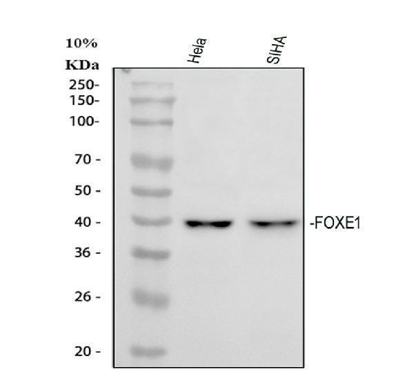  Western blot analysis of FOXE1 using anti-FOXE1 antibody (A02831-5)