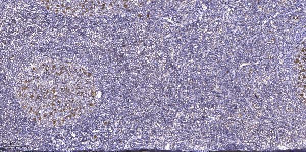 a02831 foxe1 primary antibodies ihc testing 1