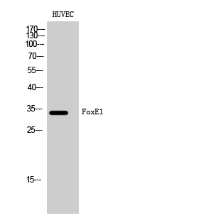 Western Blot analysis of HUVEC cells using FoxE1 Polyclonal Antibody cells nucleus extracted by Minute TM Cytoplasmic and Nuclear Fractionation kit 