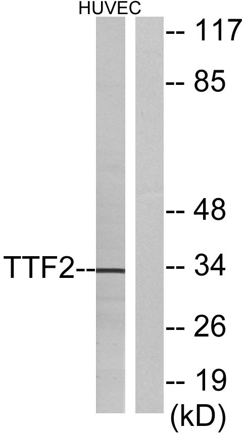 Western blot analysis of lysates from HUVEC cells, using TTF2 Antibody