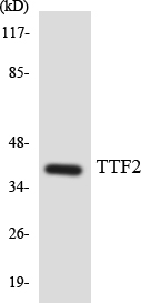 Western blot analysis of the lysates from HUVECcells using TTF2 antibody
