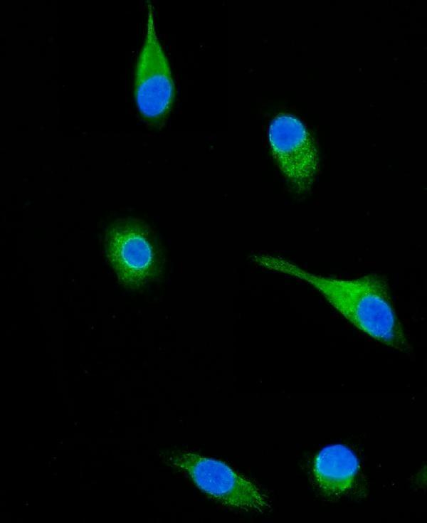  IF analysis of SH3KBP1 using anti-SH3KBP1 antibody (A02835-1)