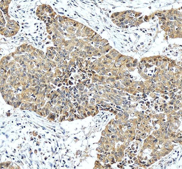 IHC analysis of HPD using anti-HPD antibody (A02838-1)