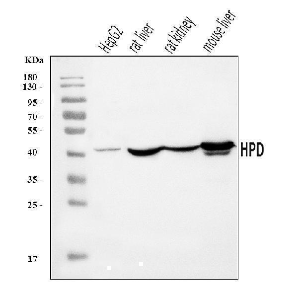  Western blot analysis of HPD using anti-HPD antibody (A02838-1)