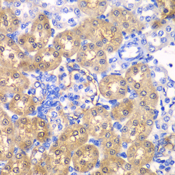 a02838 hpd primary antiboties ihc testing 2