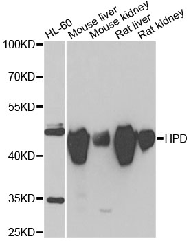 a02838 hpd primary antiboties wb testing 1